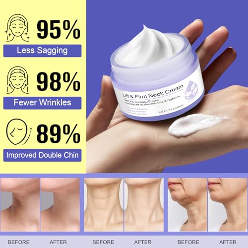 RoongDuuDll Neck Firming Cream