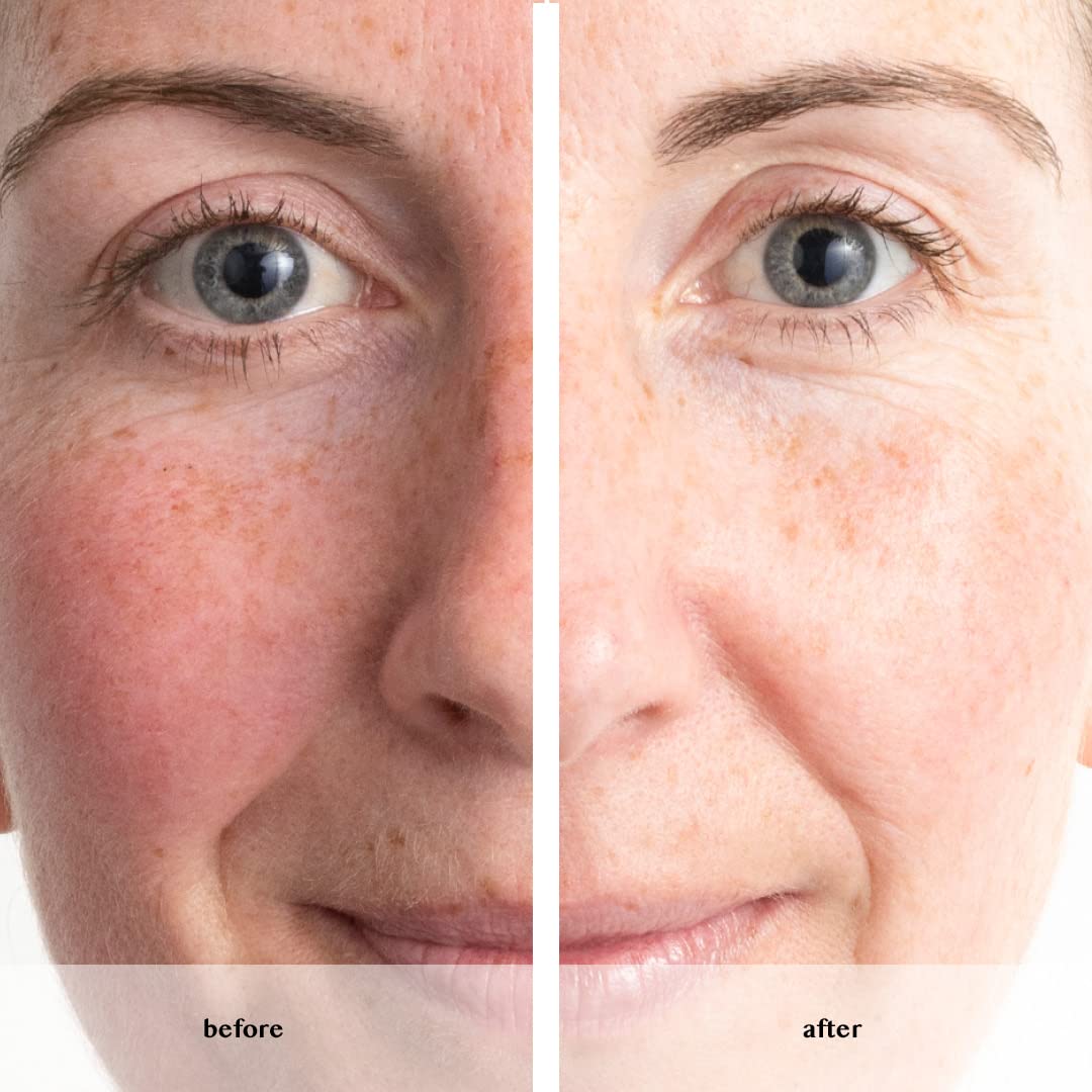 Avon Anew Renewal Power Serum & Revival Lip Treatment Duo