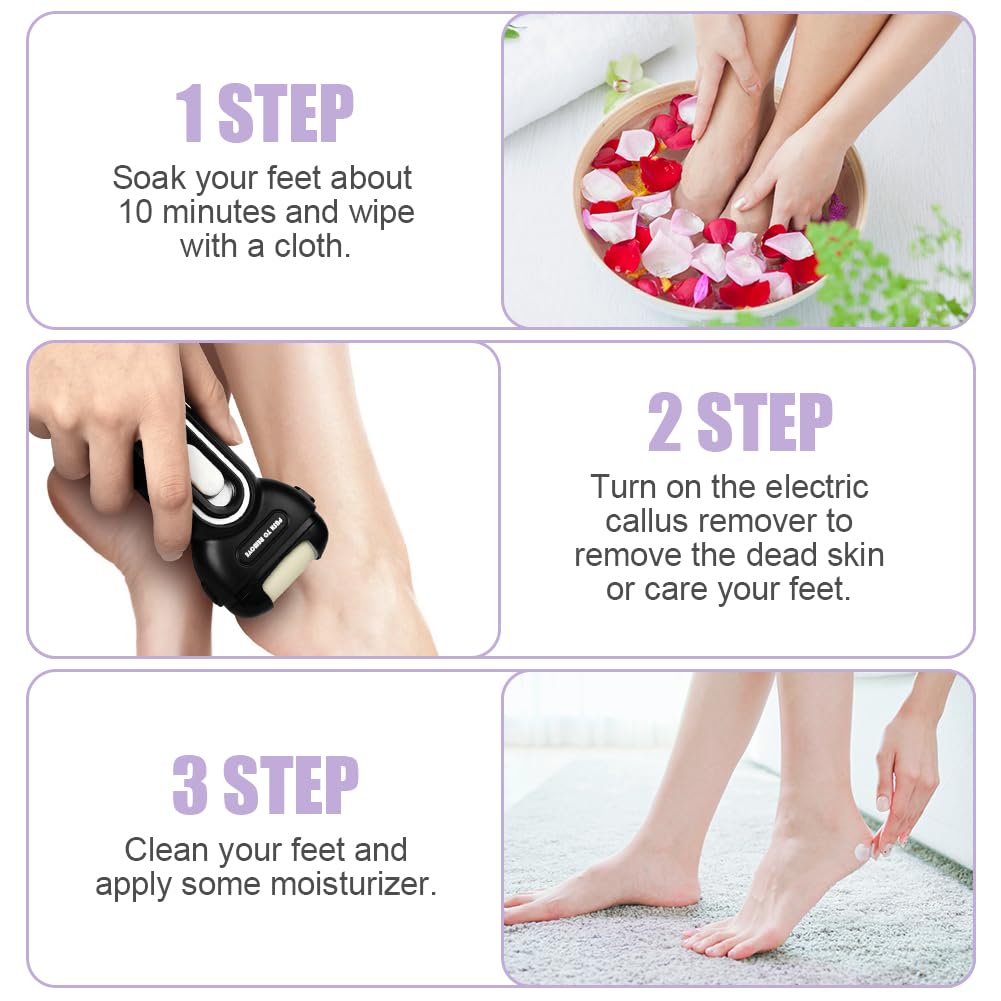 ACWOO Professional Electric Foot File