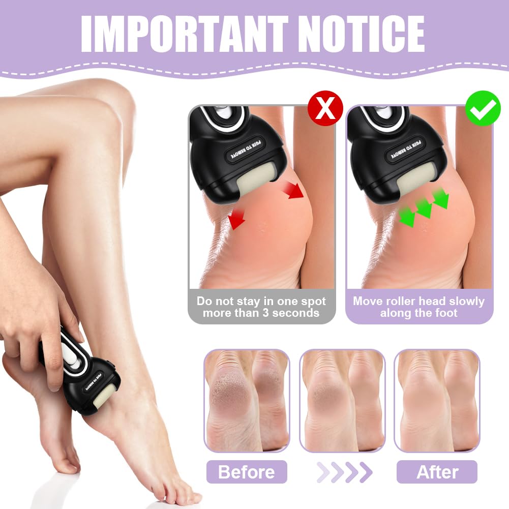 ACWOO Professional Electric Foot File