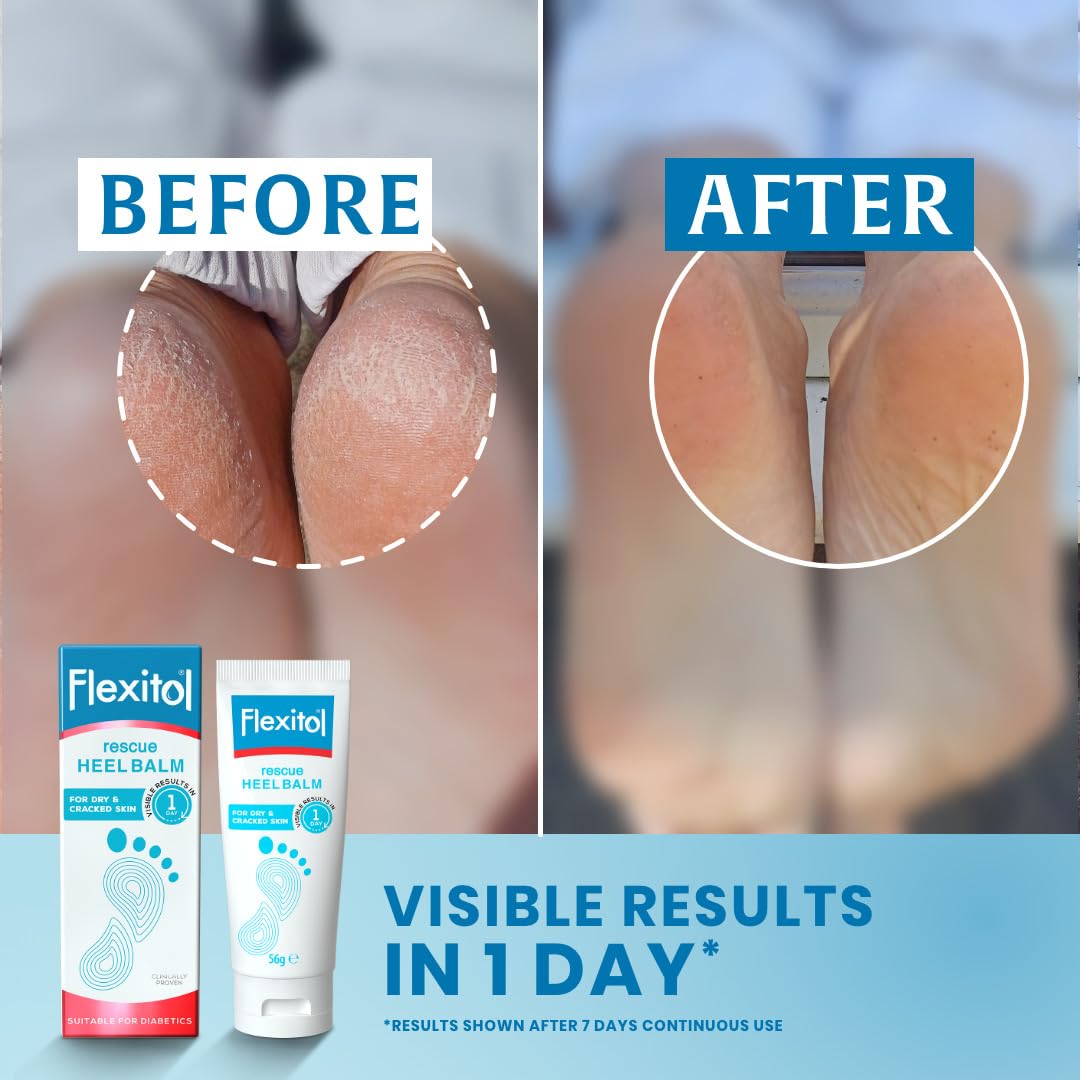 Flexitol Rescue Heel Balm 56g