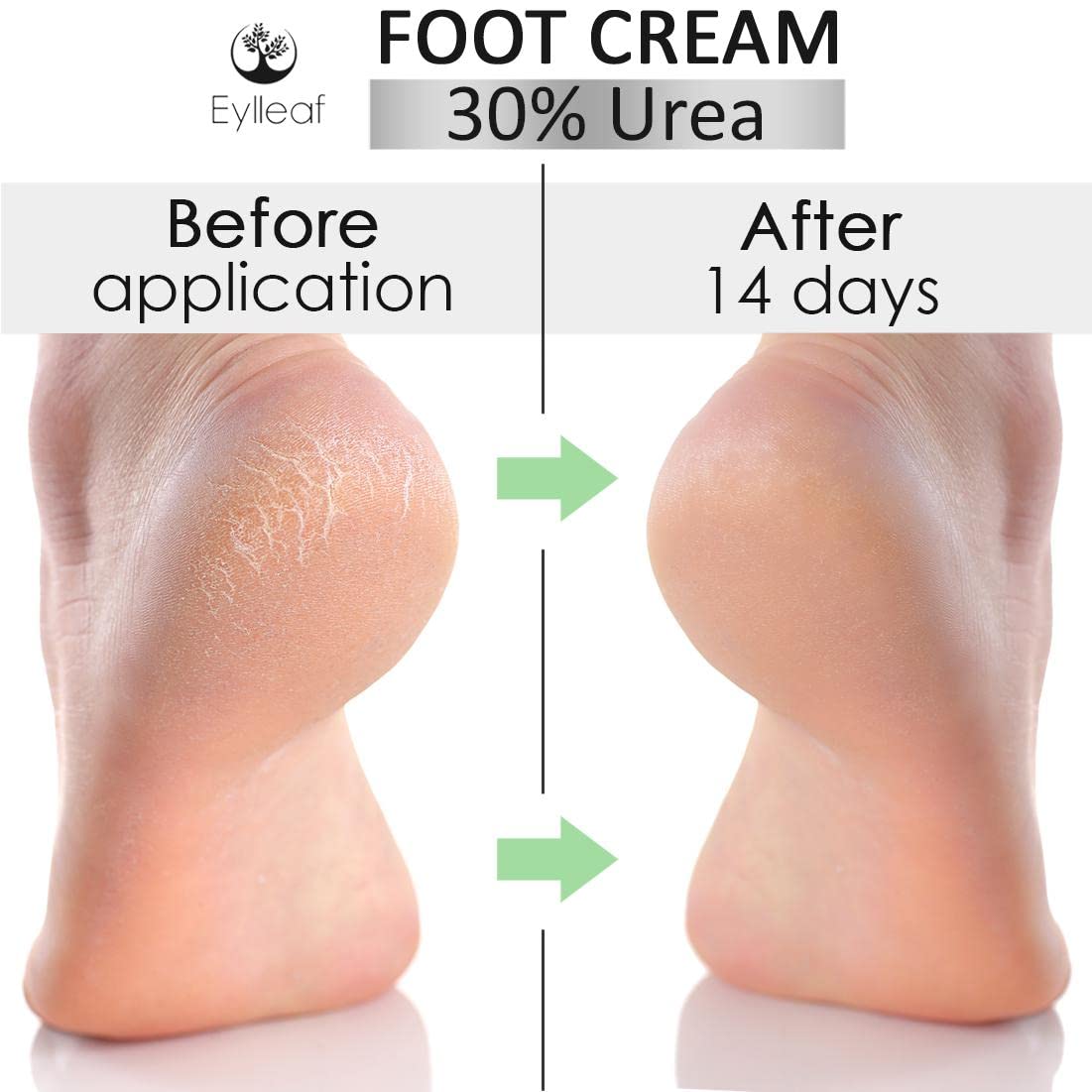 Eylleaf Intensive Foot Repair Cream with 30% Urea, 200ml