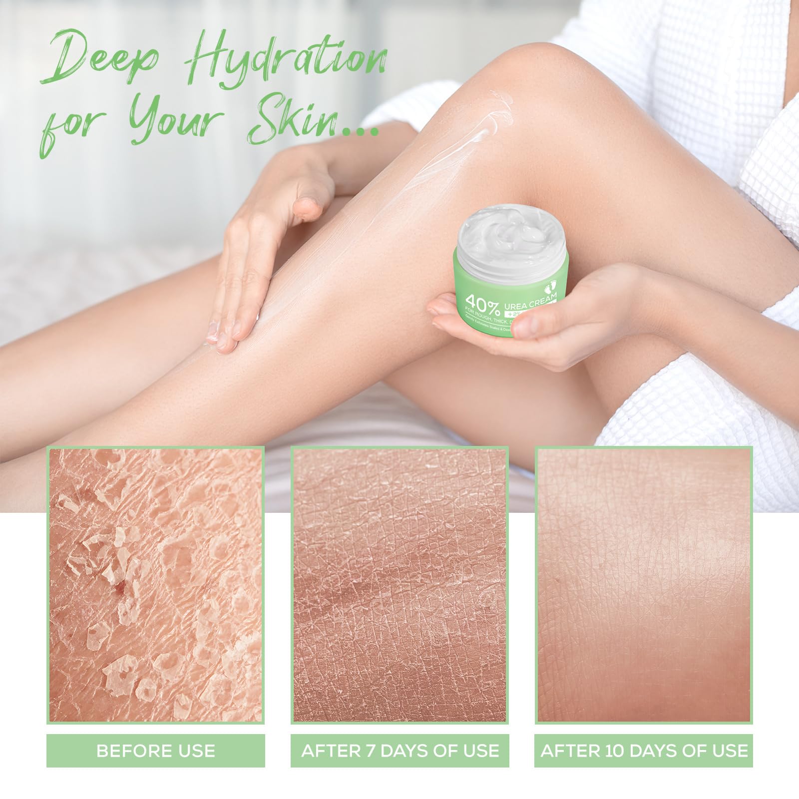 Advanced Urea Foot Cream 40% - Deep Hydration & Repair