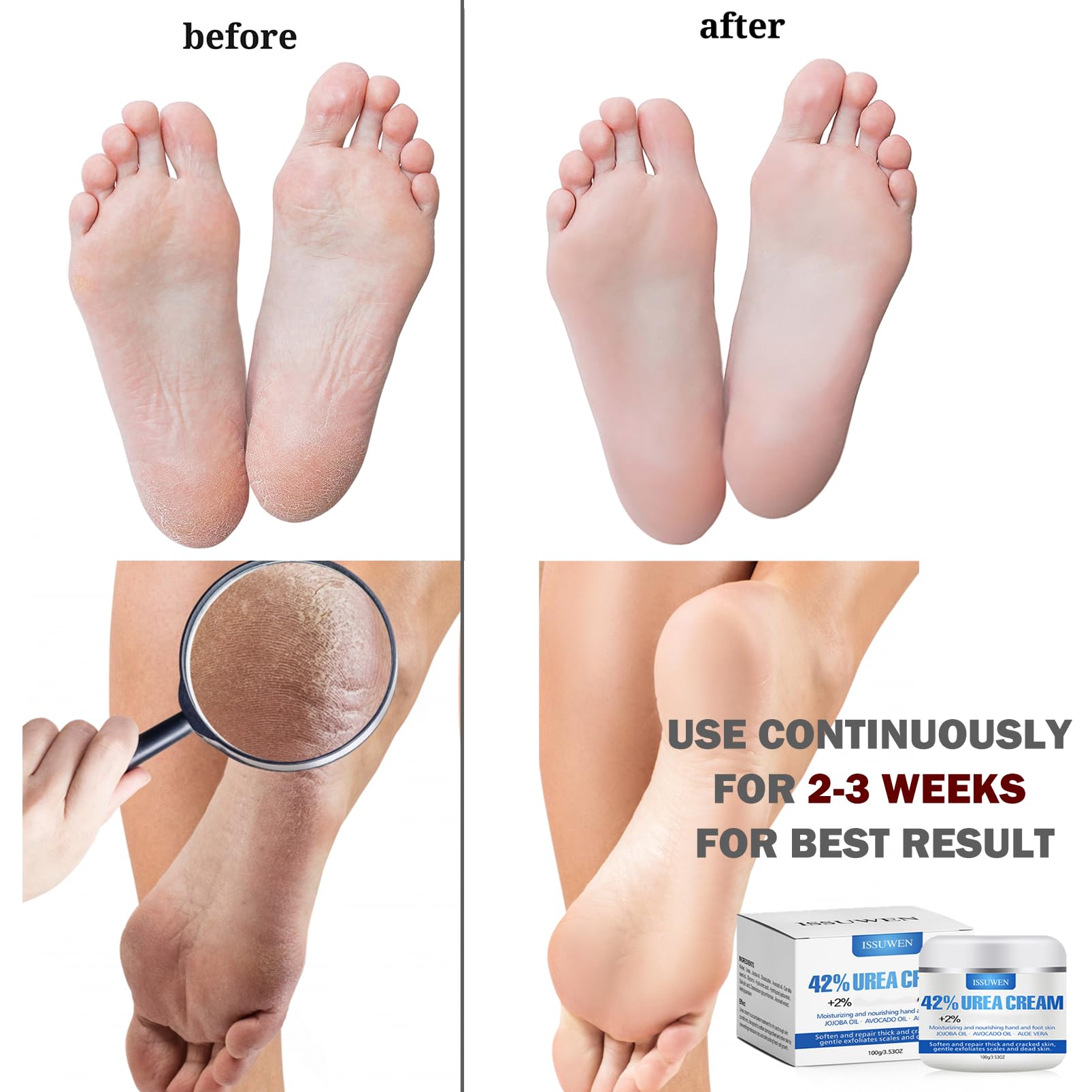 Maggidea Urea 42% Foot Cream - Intensive Repair & Hydration 100g