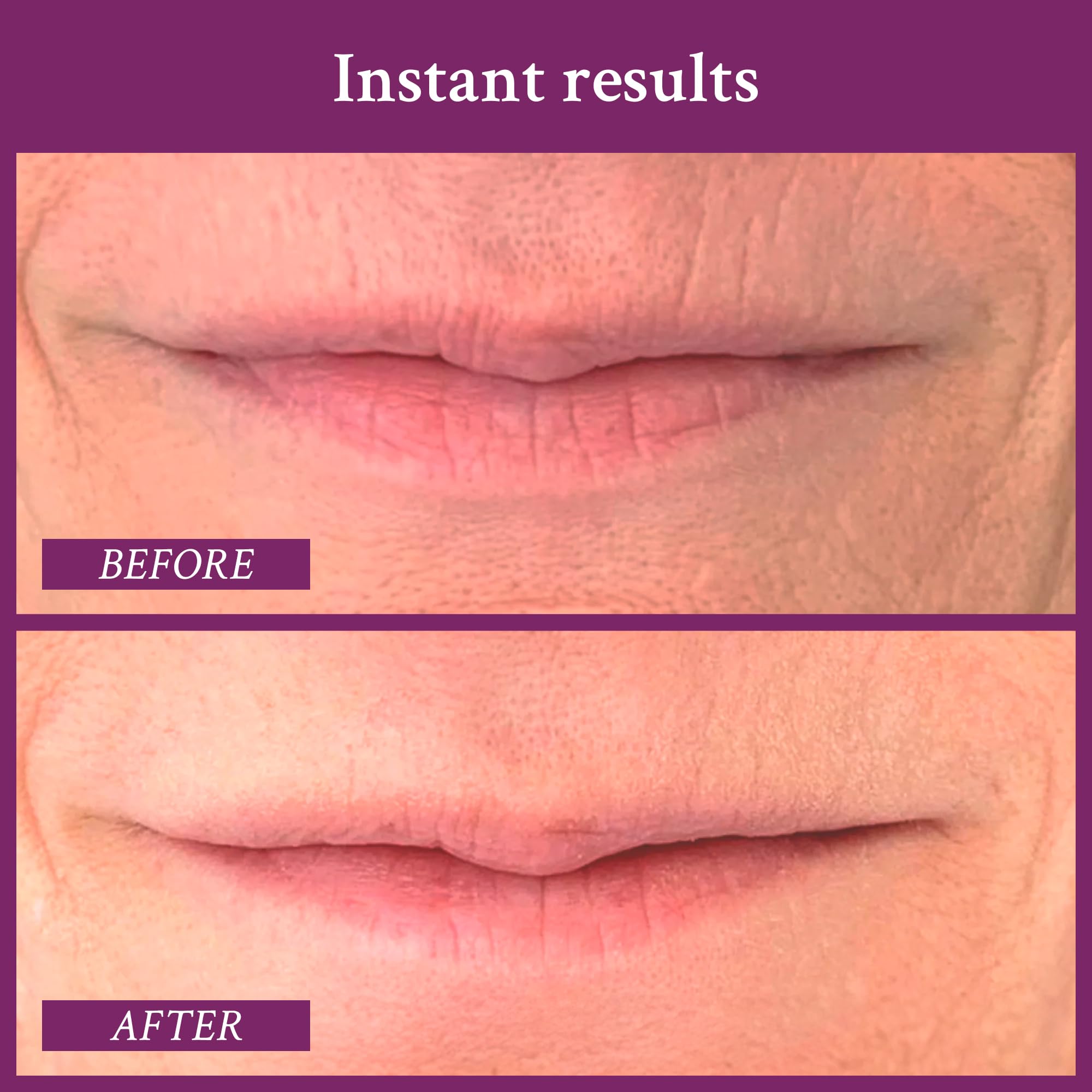 PRAI Ageless Lip & Line Filler