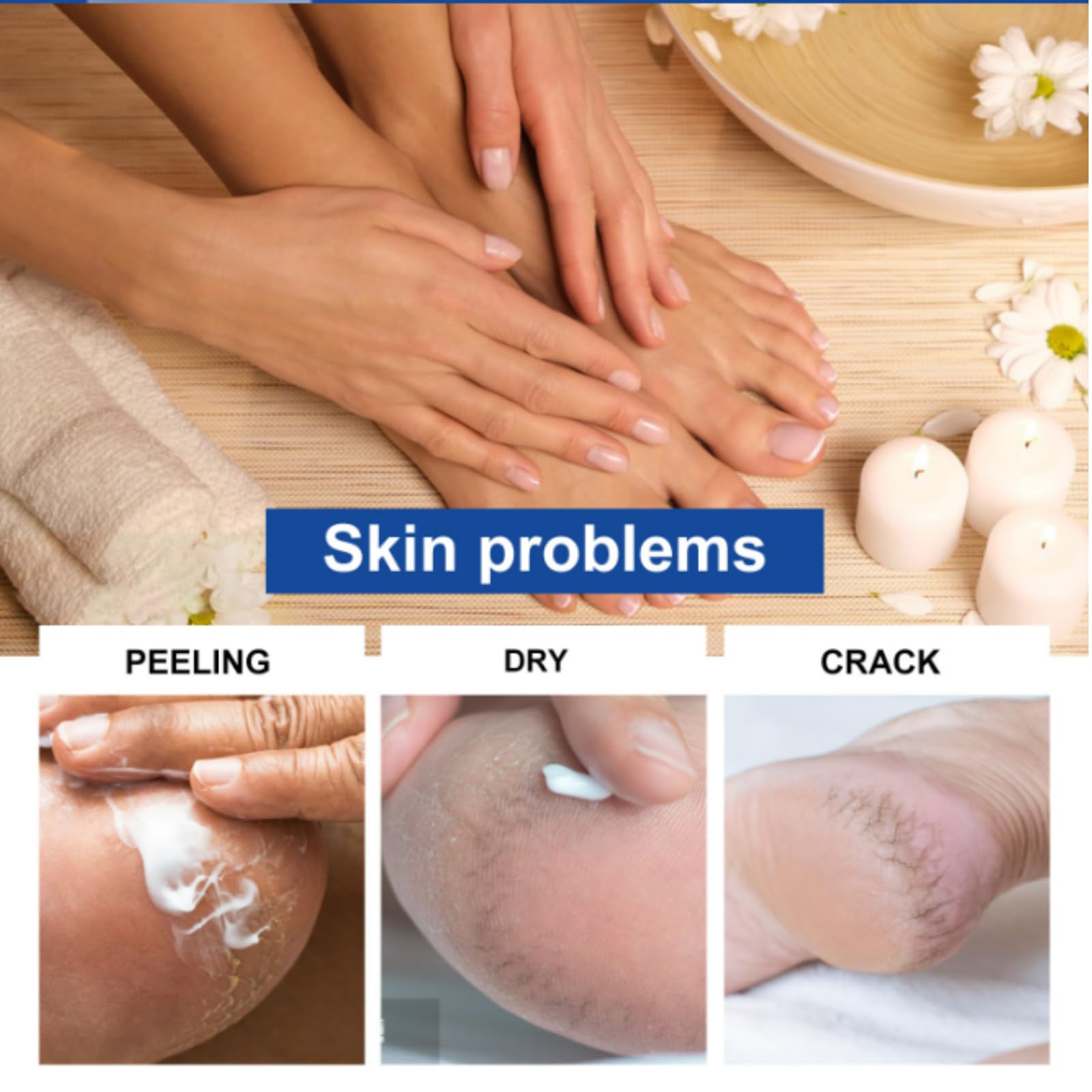 ISBEAUSOLS 40% Urea Foot Cream with Salicylic Acid & Tea Tree