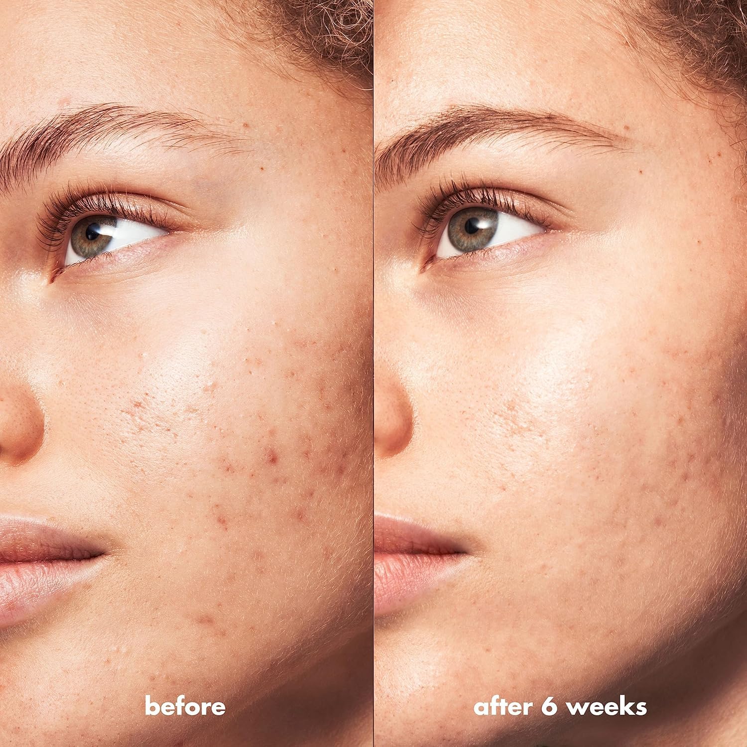 e.l.f. SKIN Blemish Breakthrough Clarifying Cleanser